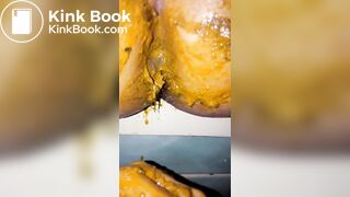 Girl diarrhea on her boyfriend hand