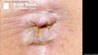 Slide show of close up shitty assholes