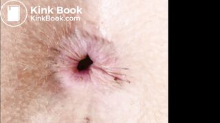 Slide show of close up shitty assholes