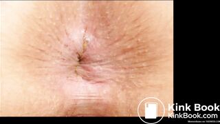 Slide show of close up shitty assholes