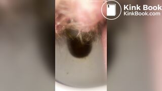 Constipated - laxatives helped a little