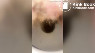 Constipated - laxatives helped a little