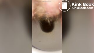 Constipated - laxatives helped a little