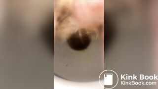 Constipated - laxatives helped a little