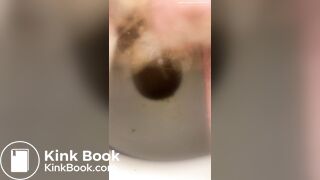 Constipated - laxatives helped a little