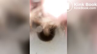 Constipated - laxatives helped a little