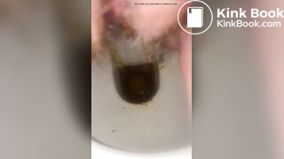 Constipated - laxatives helped a little