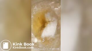 恋人 の うんち 十八