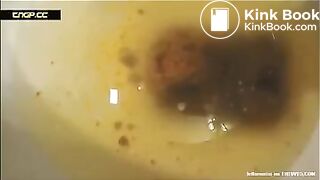 Girl pooping - video 488