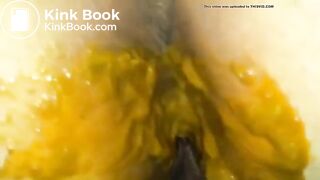 Dutch diarrhea accident..