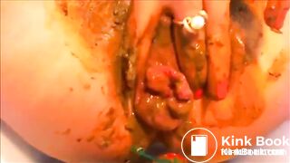 Poopy prolapse..