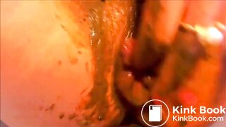 Poopy prolapse..