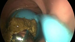 girls dirty vibrator removed