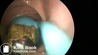 girls dirty vibrator removed