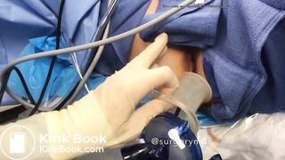 girls dirty vibrator removed