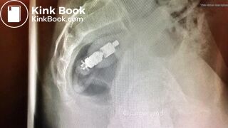 girls dirty vibrator removed