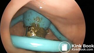 girls dirty vibrator removed