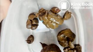 girl shits stone like turds in a container
