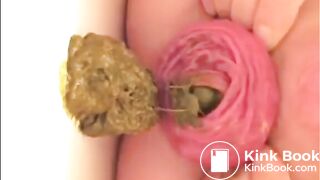 prolapsed japanese open wide