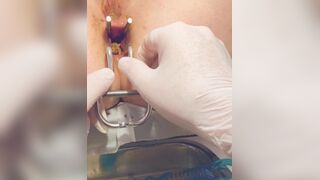 Urine sample at gyno p. 2/2B