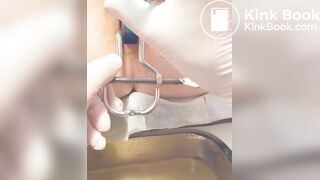 Urine sample at gyno p. 2/2B