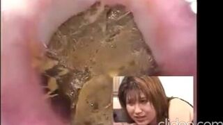 Shitting after enema - video 3