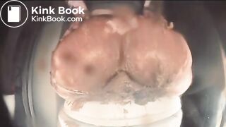 BP white panty shit smear