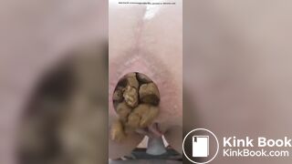 this girl is shitting alot of nuggets