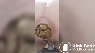 this girl is shitting alot of nuggets