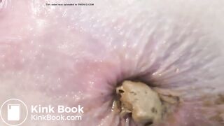 Einfach nur scheißen und pissen