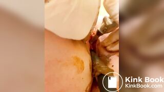 Urethra scat until anal urination