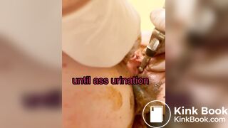 Urethra scat until anal urination