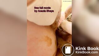 Urethra scat until anal urination