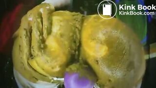 BP white pantie shit smear