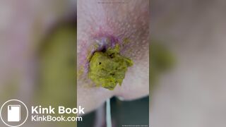 Close Up Teen Shits While Dripping Slimy Wet Cum