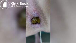 Close Up Teen Shits While Dripping Slimy Wet Cum