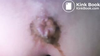 Big poo on open diaper..