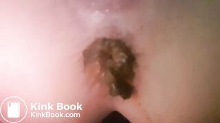 Big poo on open diaper..