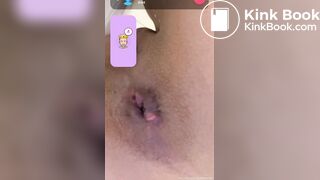 some poo came out of this young girl's anus