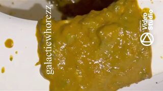 Girl has explosive diarrhea with huge mess on toilet