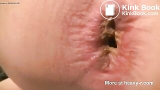 Close up pooping - video 18