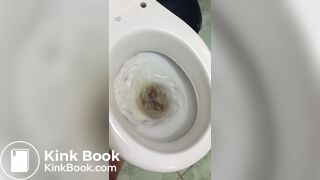 Woman tries to flush toilet, but feces won't go down