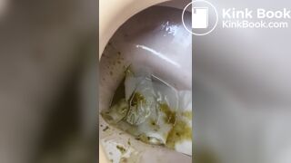 Japanese girl with diarrhea - video 5