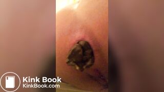 Young girl close up shitting 1