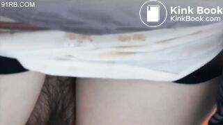 Chinese woman has diarrhea 08
