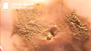 Putting panties back on after big shit