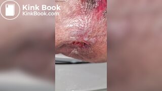 Groaning painful poop out