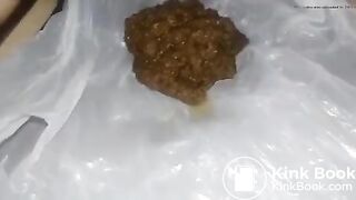 Fat diarrhea again