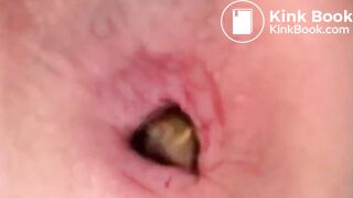 Little scat - video 5