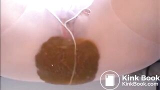 Creamy diarrhea - video 2